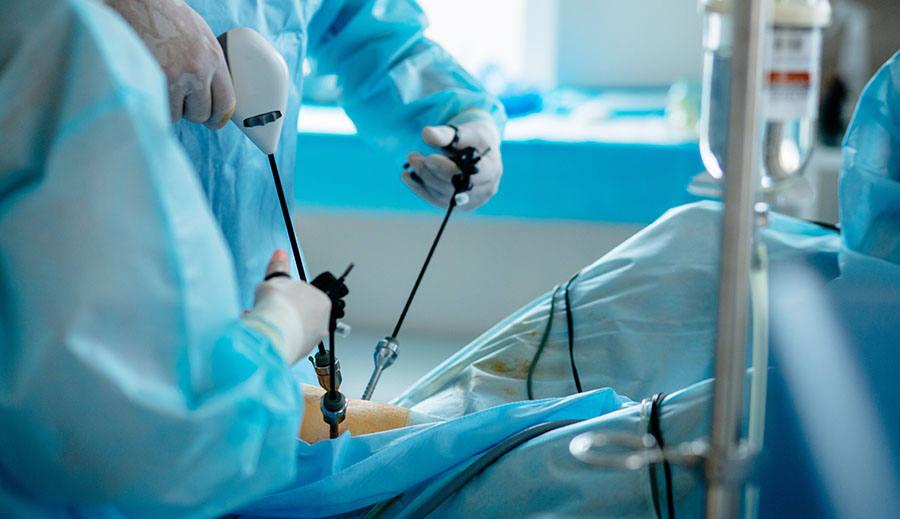 Laparoscopic Surgery