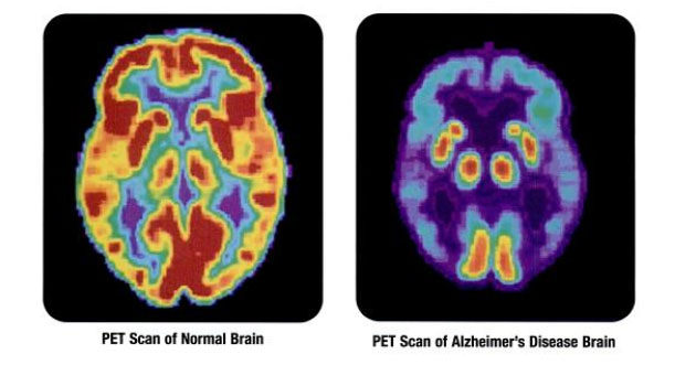 Brain scans