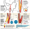 medtronic