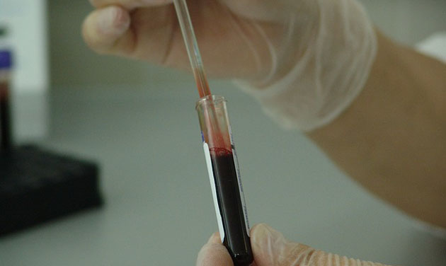 Blood test