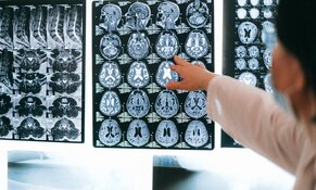 algernon stroke drug