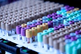 lab lab